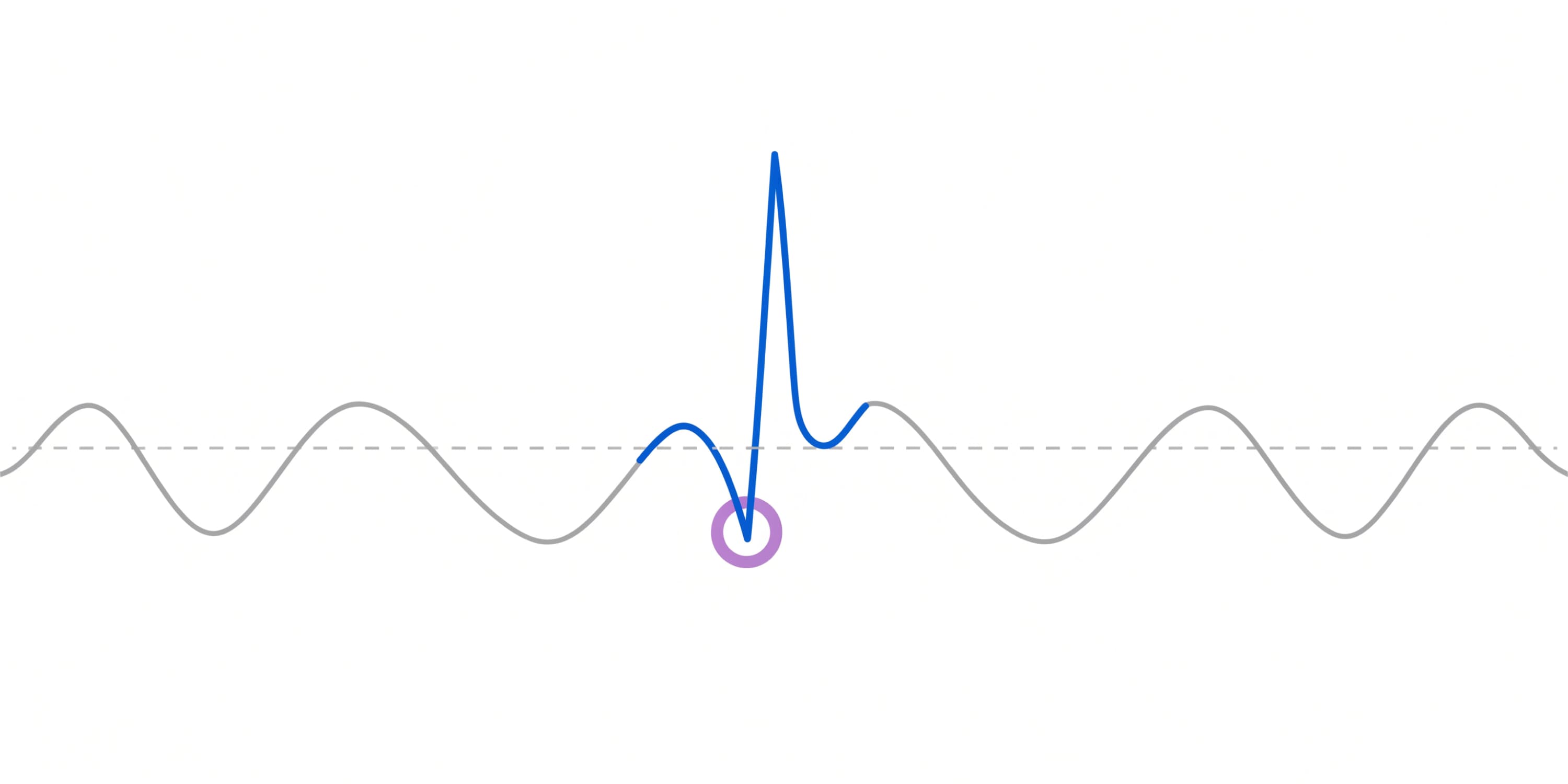 A horizontal metric trend line drawn in soft gray with a highlighted upward spike in blue and a small lavender circular anomaly marker; a dashed horizontal band beneath represents the metric's normal range